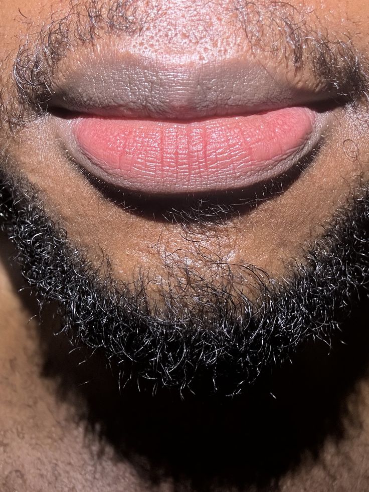 Lip Treatment